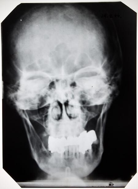 Docs reveal Hitler farted, received sex injections, craved cocaine