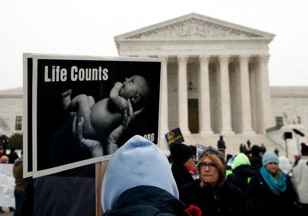 Red states should all pass their own heartbeat bills
