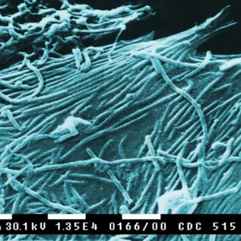 WH: ‘Screening Procedures In Place At Our Border’