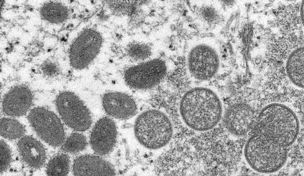 Biden orders 2.5 million monkeypox vaccines as cases eclipse 1,400