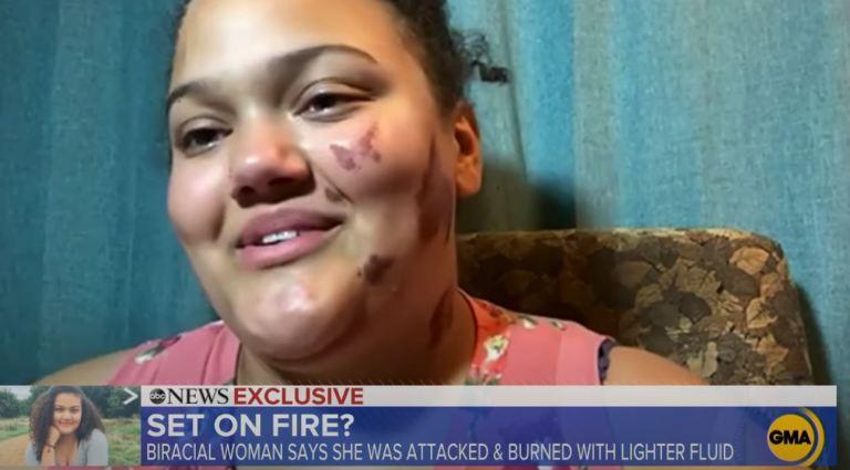 St. Louis prosecutor investigating possible charges against armed couple for ‘intimidation’ of protesters