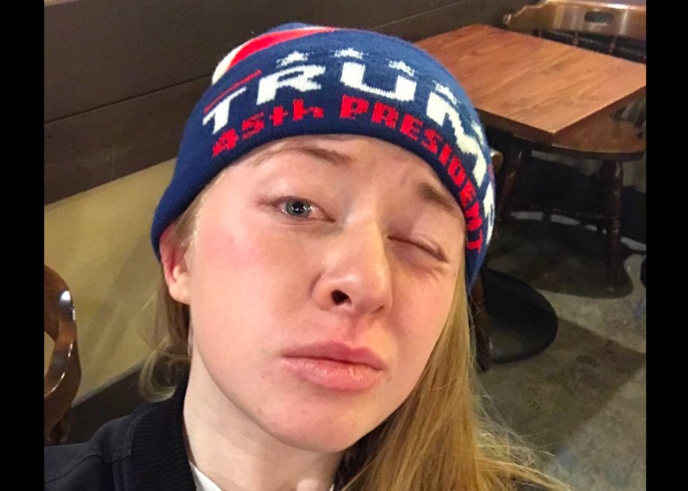 Kiara Robles was pepper sprayed during an interview with an ABC affiliate by a masked assailant during protests over a speech by former Breitbart editor Milo Yiannopoulos. (Twitter)