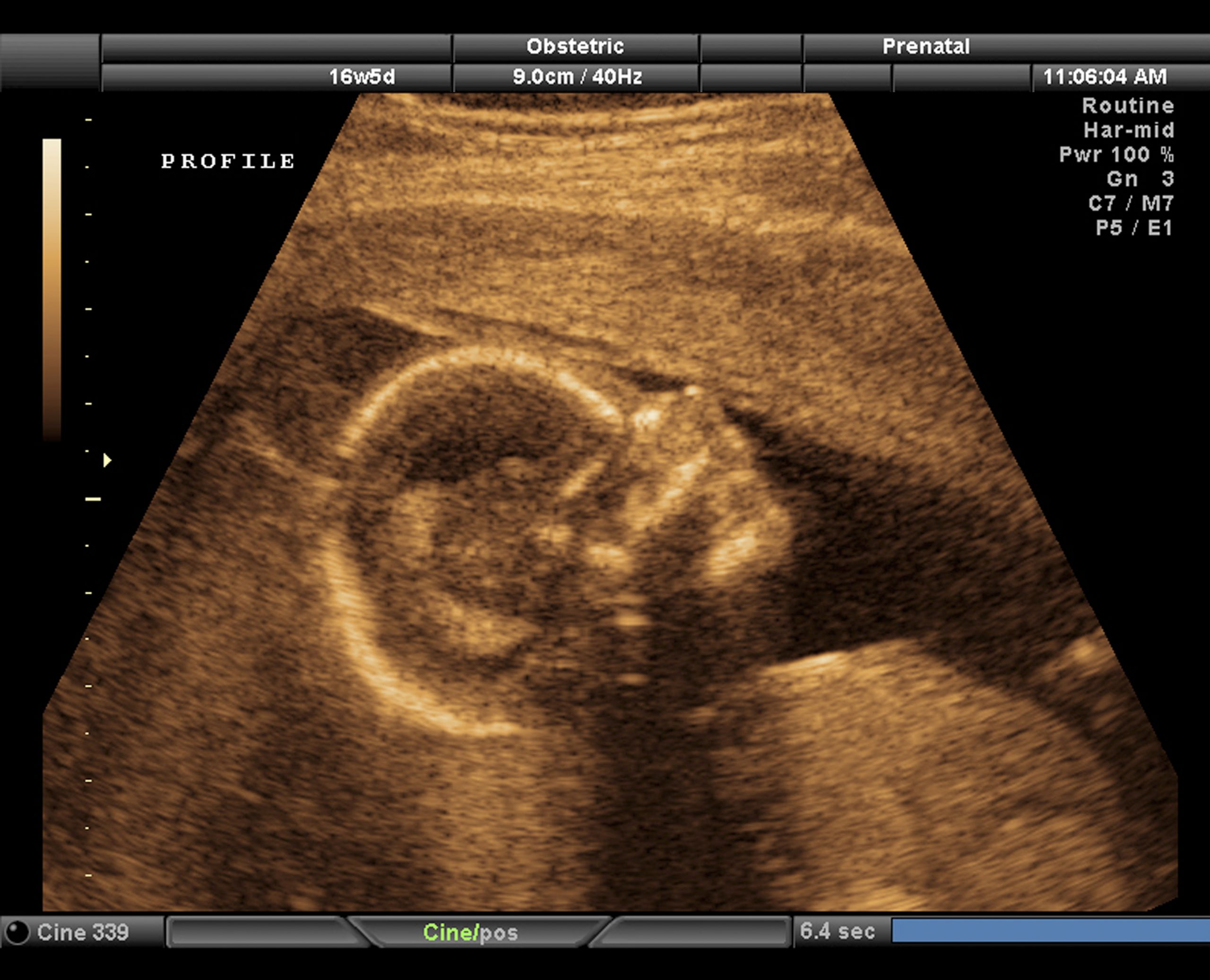 On the abortion front, good news for babies