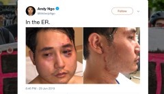 Andy Ngo’s commentary doesn’t undermine his news reporting