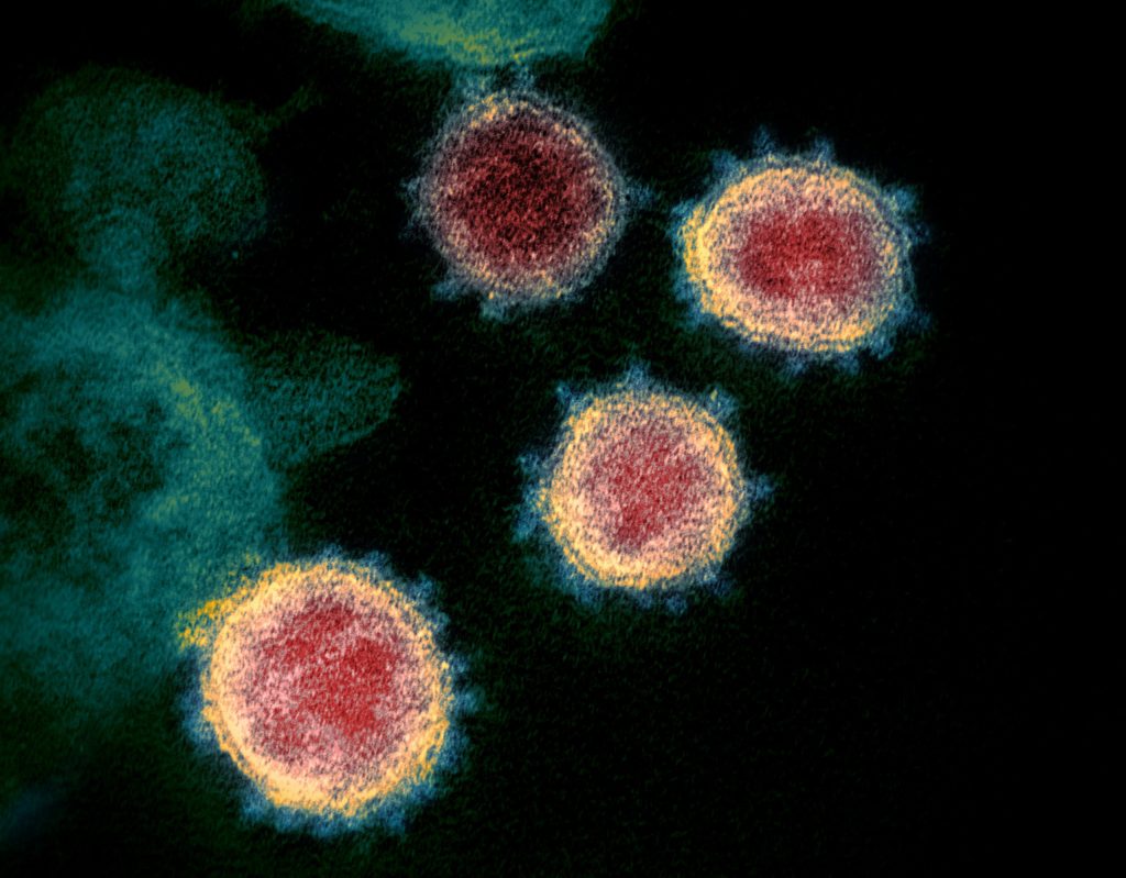Variants may be responsible for coronavirus cases that evade vaccines, CDC finds