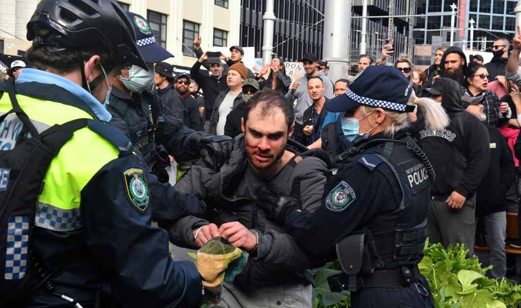 Australia’s COVID response is evil and dumb