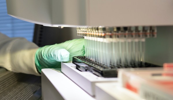 Approval of controversial $56,000 Alzheimer’s treatment could add $57 billion to federal spending