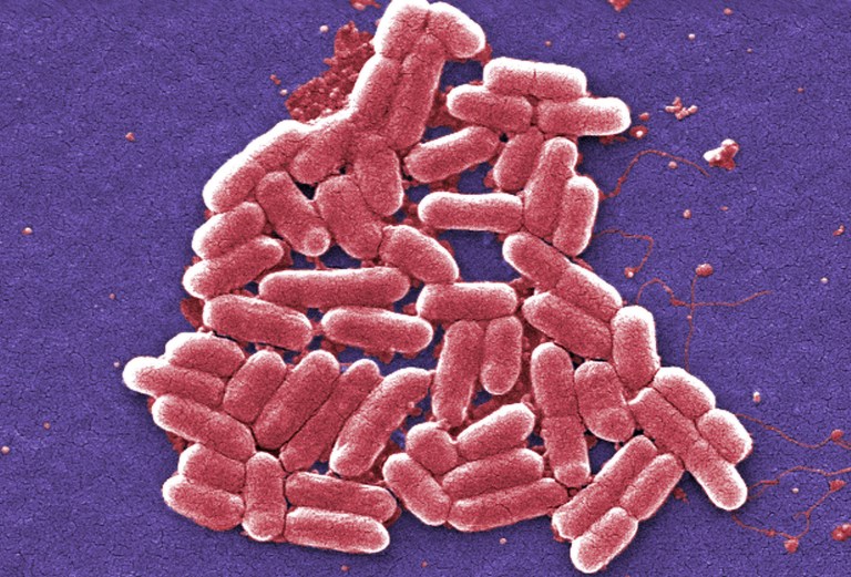 At least 23,000 people die from superbugs each year and at least 2 million people get infected with bacteria resistant to antibiotics, according to the Centers for Disease Control and Prevention. (Janice Carr/CDC via AP)