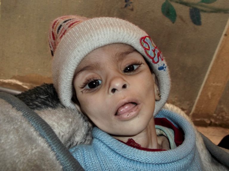 FILE - This undated activist file photo provided by the group Palestinians of Syria shows Israa al-Masri, a baby who later died of hunger-related illness on Jan. 11, 2014 in the Palestinian neighborhood of Yarmouk in Damascus, Syria. The chief of the United Nations relief agency supporting Palestinian refugees, Filippo Grandi, said Tuesday he is 