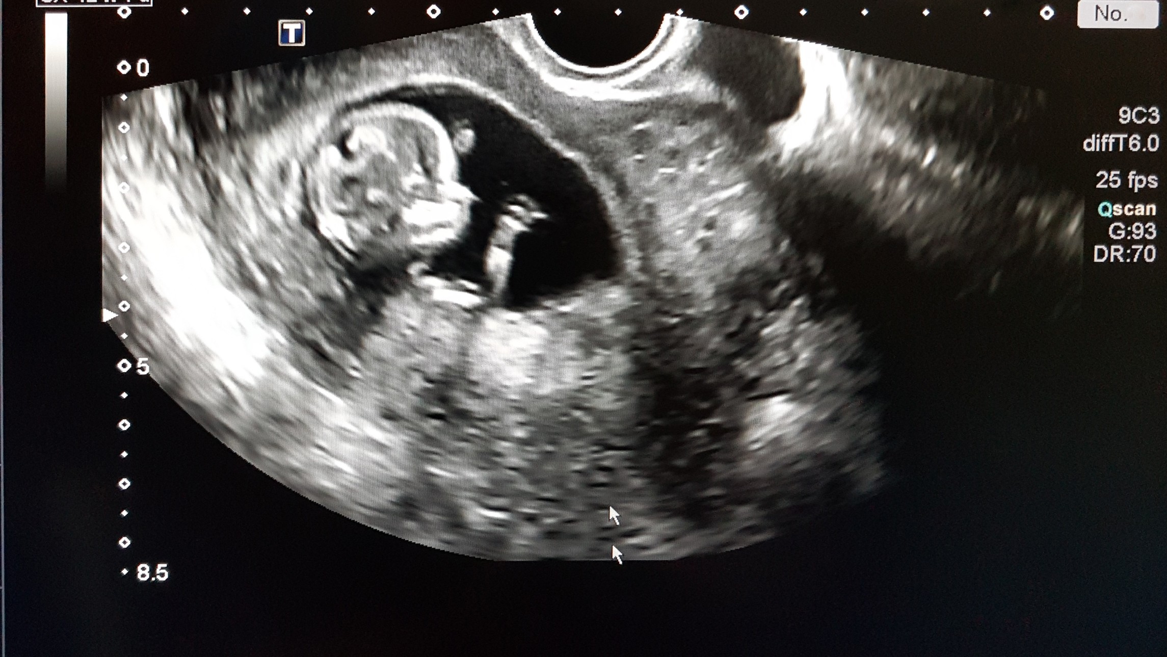 At 15 weeks of fetal development, humans are complex