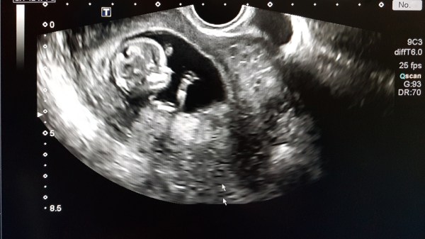 Abortion and the ownership of other human beings