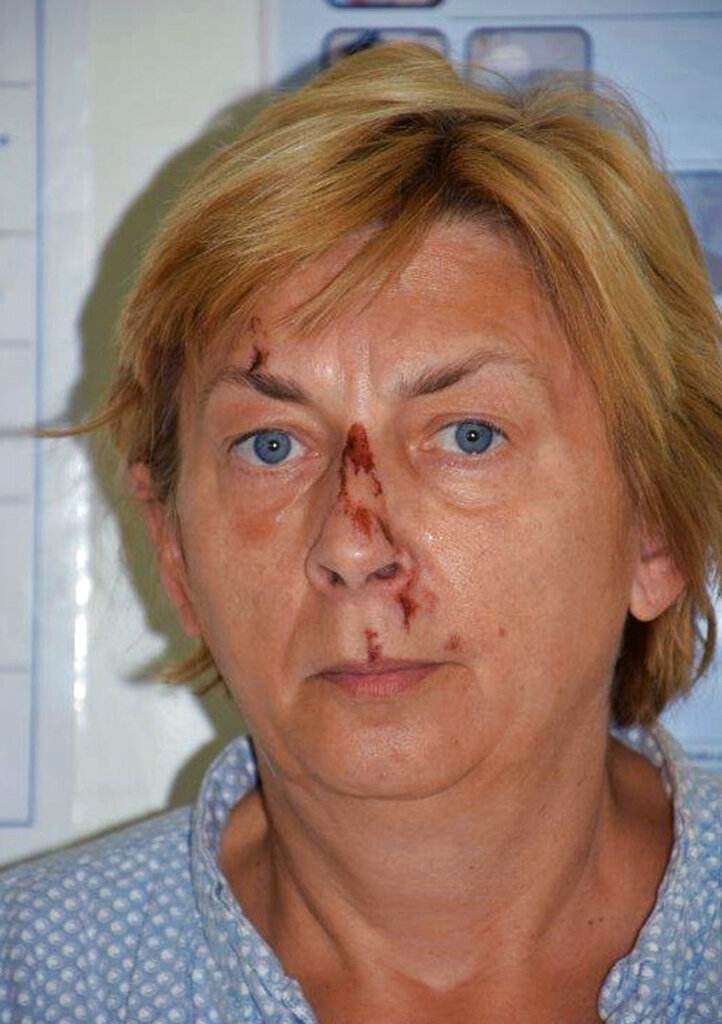 This undated photo provided by the Croatian Police shows an unidentified woman who was found on the Adriatic island of Krk on Sept. 12, 2021.