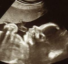 The pervading dishonesty of Roe v. Wade