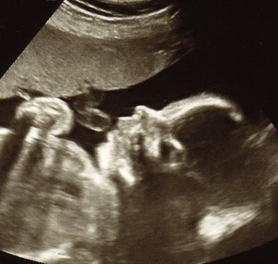 The pervading dishonesty of Roe v. Wade