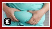 Obesity changes brain chemistry: What new research means for healthcare