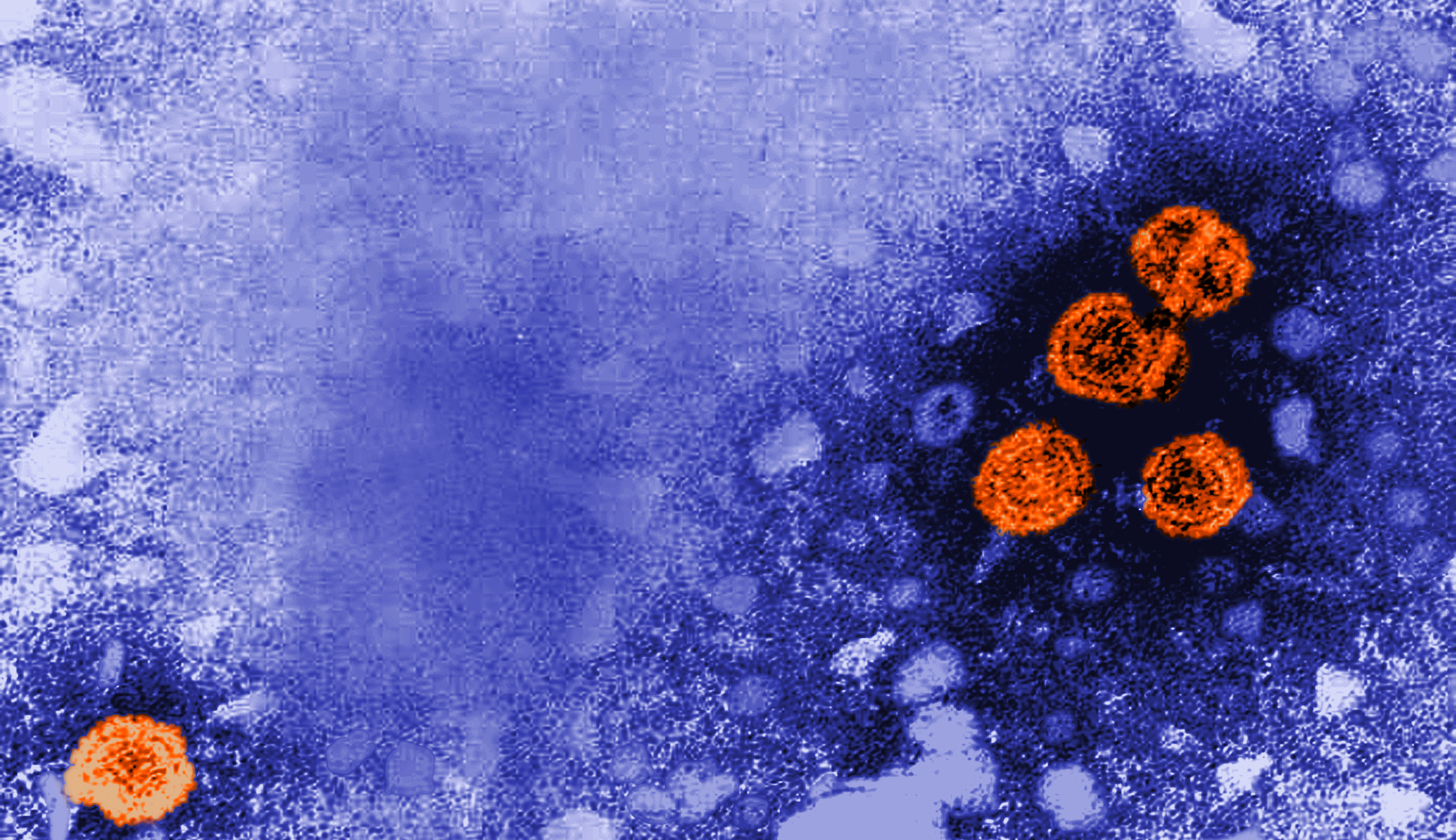 Health officials raise alarm about mysterious hepatitis cases in children