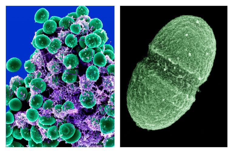   At left, undated handout image provided by the National Institute of Allergy and Infectious Diseases (NIAID) shows a clump of Staphylococcus epidermidis bacteria (green) in the extracellular matrix, which connects cells and tissue, taken with a scanning electron microscope, showing. At right, undated handout image provided by the Agriculture Department showing the bacterium, Enterococcus faecalis, which lives in the human gut, is just one type of microbe that will be studied as part of NIH's Human Microbiome Project. They live on your skin, up your nose, in your gut _ enough bacteria, fungi and other microbes that collected together could weigh, amazingly, a few pounds. Now scientists have mapped just which critters normally live in or on us and where, calculating that healthy people can share their bodies with more than 10,000 species of microbes. (AP Photo/NIAID, Agriculture Department)  