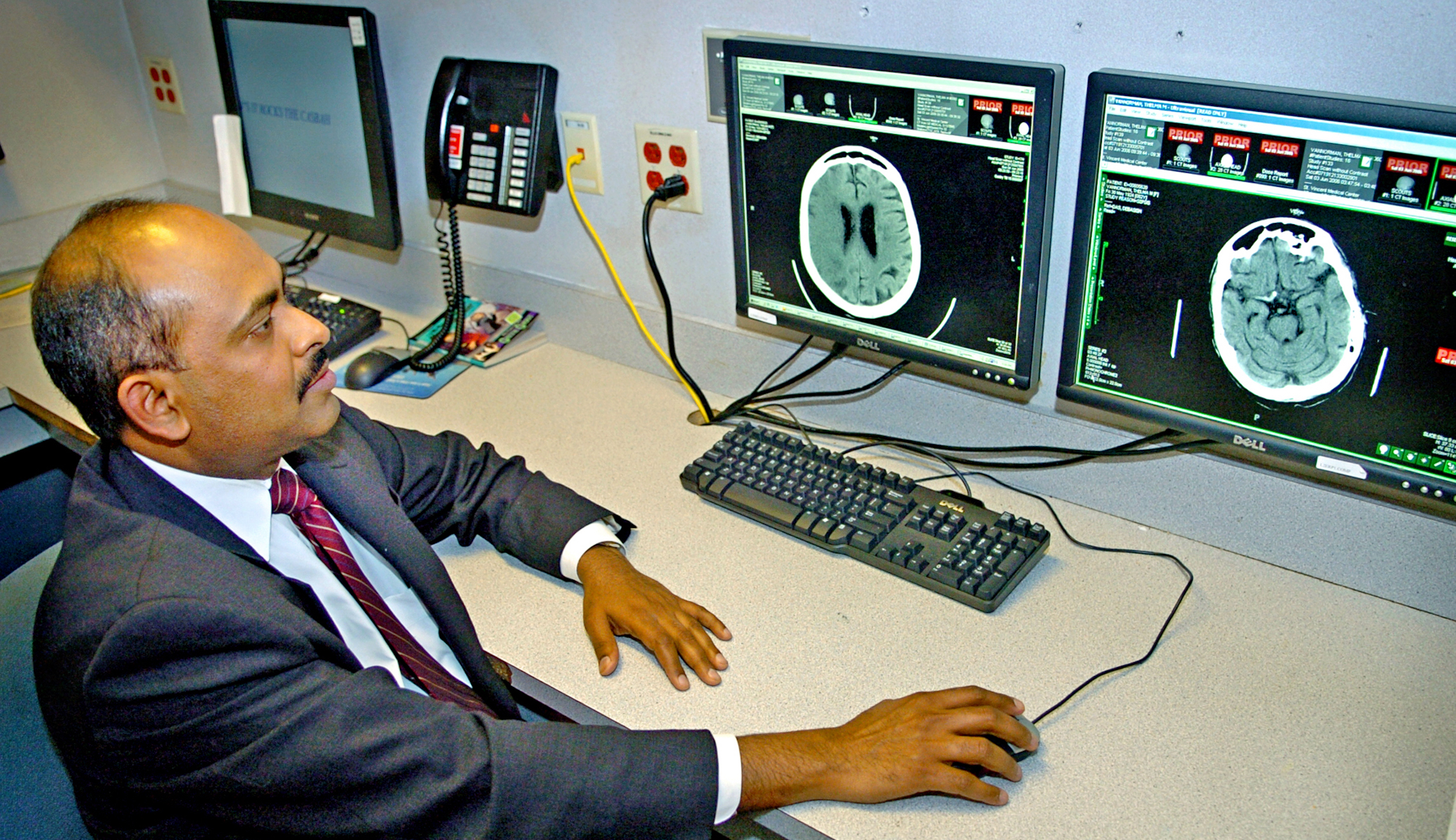 Daily chores and other light physical activity lower risk of stroke: Study