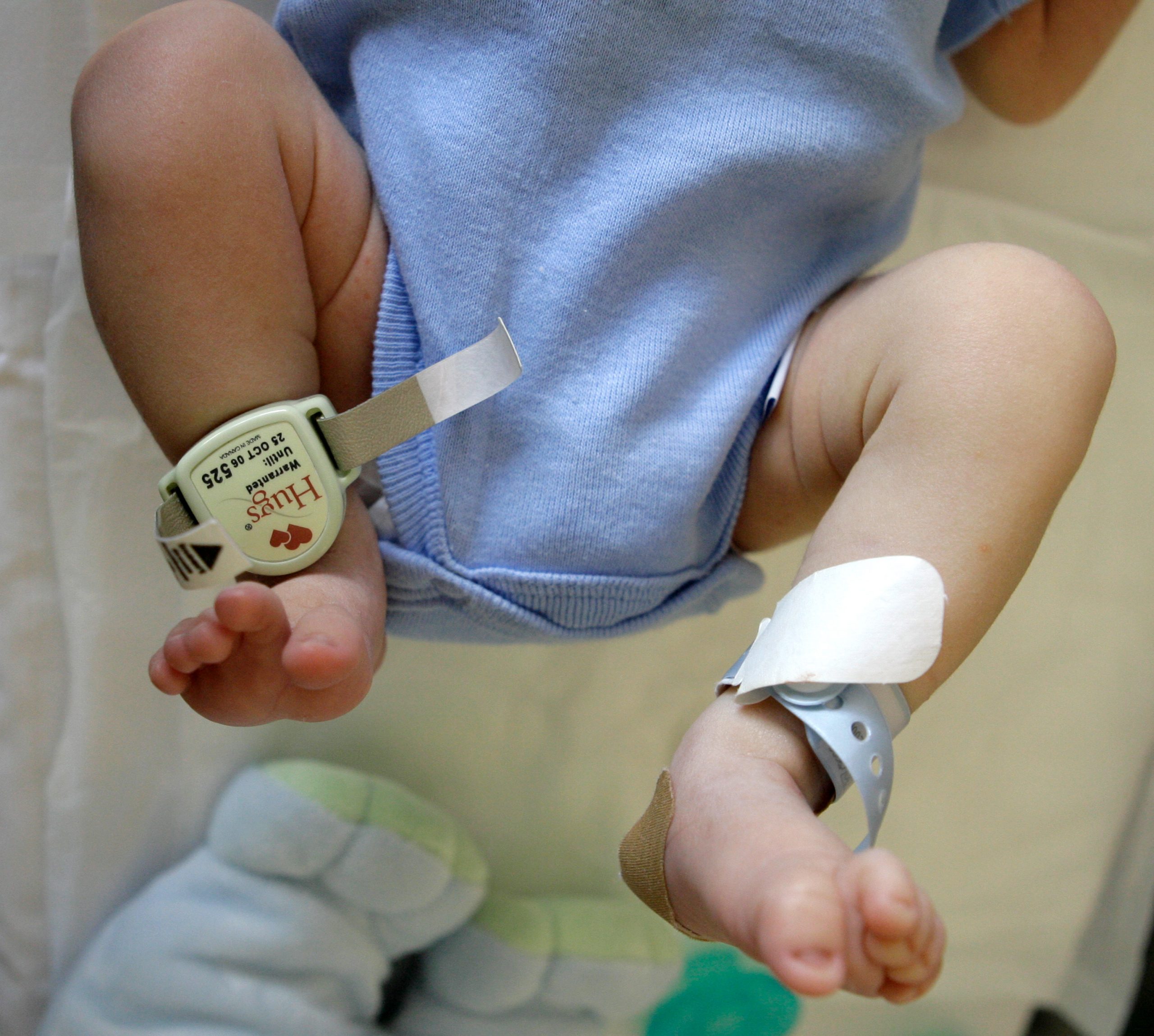 CDC sounds alarm on ‘heartbreaking’ rise in newborn syphilis rates