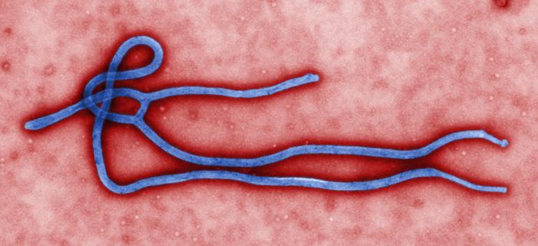 FILE - This undated file image made available by the CDC shows the Ebola Virus. U.S. health officials have warned for months that someone infected with Ebola could unknowingly carry the virus to this country, and on Tuesday, Sept. 30, 2014, came word that it had happened: A traveler in a Dallas hospital became the first patient diagnosed in the U.S. (AP Photo/CDC, File)