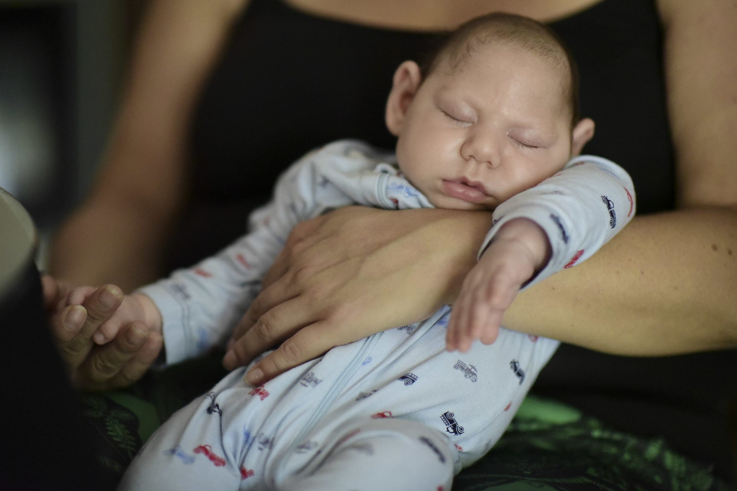 CDC: 10 percent of Zika-affected pregnancies show birth defects