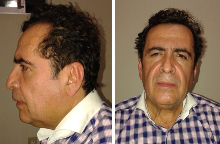 This two-image composite released by Mexico's Attorney General's Office (PGR) on Wednesday Oct. 1, 2014, shows alleged cartel capo Hector Beltran Leyva after his arrest by Mexican law enforcement authorities. The purported head of the Beltran Levya drug gang was captured in a seafood eatery in San Miguel de Allende, a city in the central state of Guanajuato that is a popular enclave for artists and foreigners. No shots were fired in the brief operation, which culminated an 11-month investigation, authorities said. (AP Photo/ Mexico's Attorney General's Office)