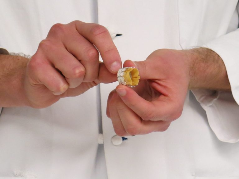 A cardiologist shows a heart valve that's used in a minimally invasive procedure called transcatheter aortic valve replacement. (AP Photo/Gosia Wozniacka)