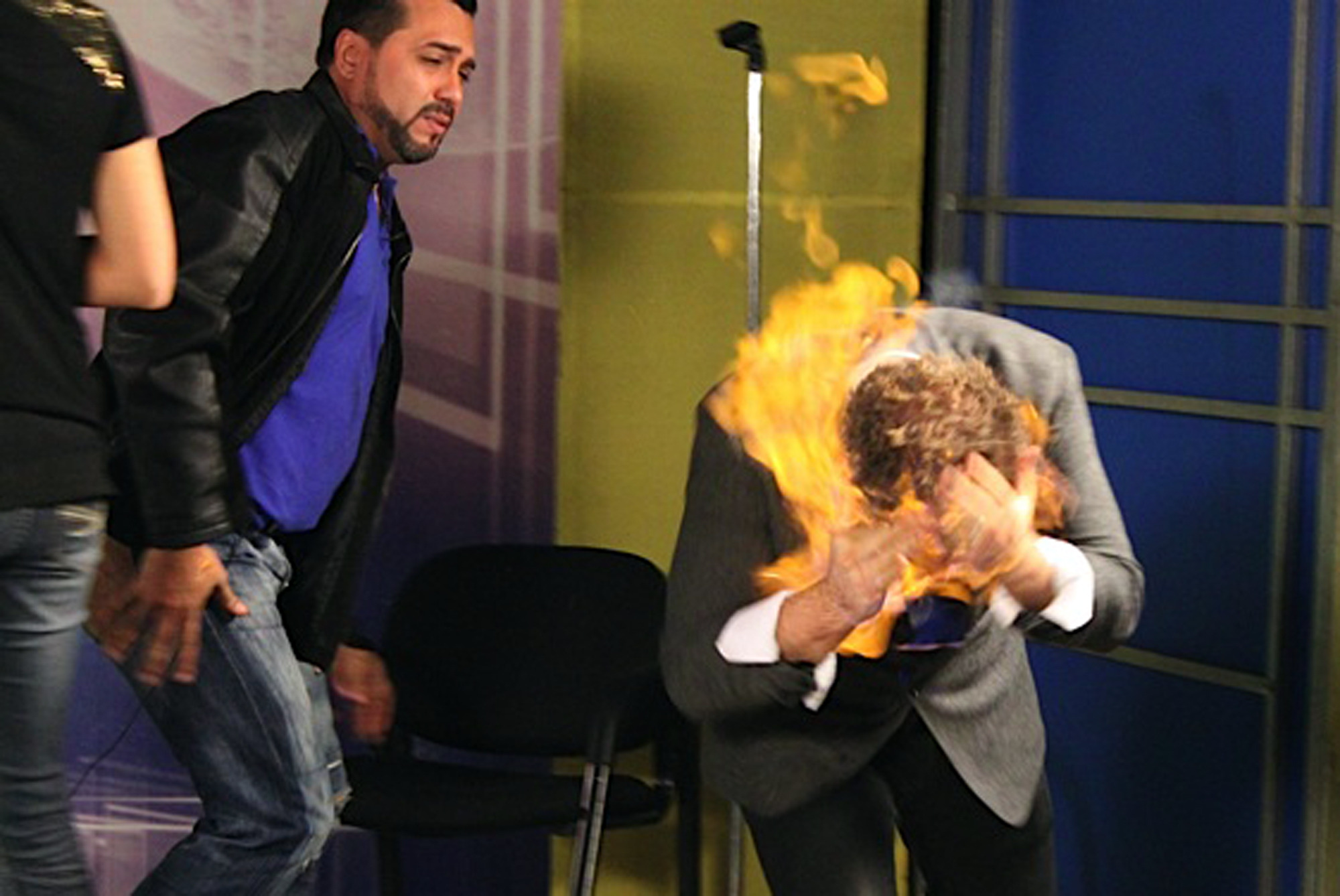 US magician burned in Dominican TV ‘stunt’
