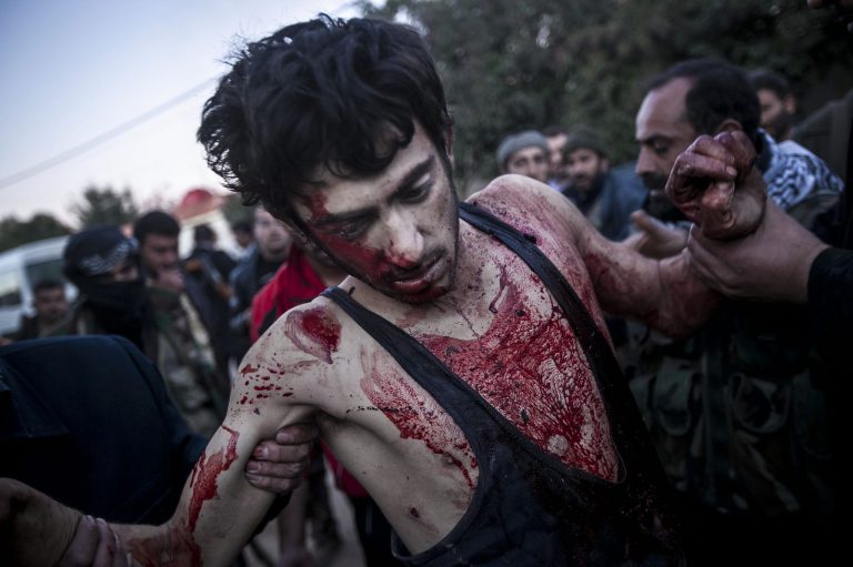   In this Saturday, Dec. 15, 2012 photo, people help a wounded Free Syrian Army fighter during heavy clashes with government forces at a military academy besieged by rebels north of Aleppo, Syria. (AP Photo/Narciso Contreras)  