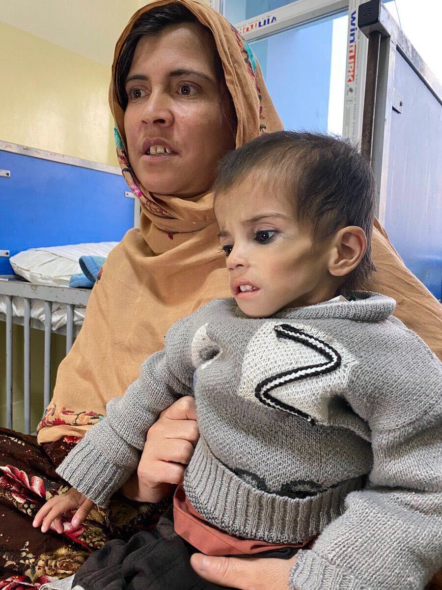 Afghanistan boy starves.jpg