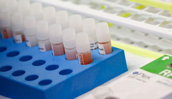 Researchers find potential coronavirus treatment in rheumatoid arthritis drug
