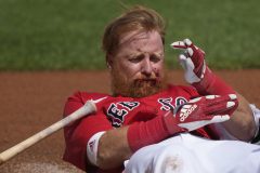 Red Sox’s Justin Turner receives 16 stitches after getting hit in face by pitch