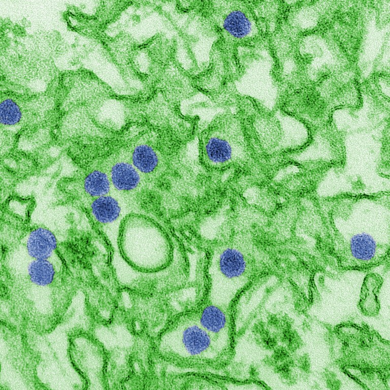 Cash for Iran, But None for Zika