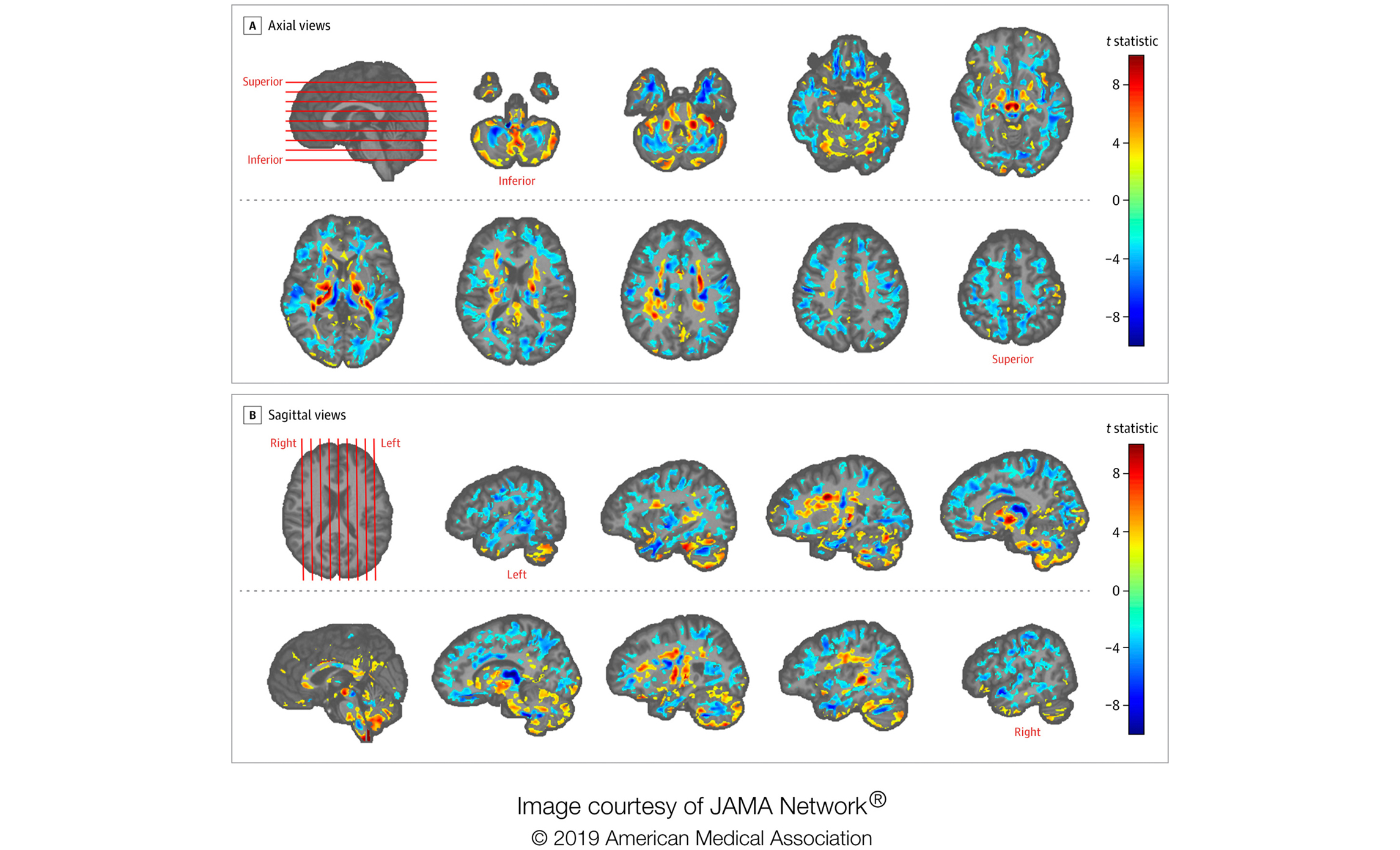 Doctors find ‘significant differences’ in brains of officials allegedly hit by sonic waves in Cuba