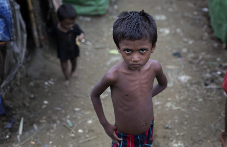 In this June 24, 2014 photo, seven-years old Mubari Khuson stands in Dar Paing, a camp for Rohingya Muslims in north of Sittwe, Rakhine state, Myanmar. Naked boys and girls run barefoot on the muddy, narrow pathways, or play in pools of raw sewage, exposing them to potential waterborne diseases that kill. Some have black hair tinged with patches of red or blond, a tell-tale sign of nutrient deficiency commonly seen in places experiencing famine.