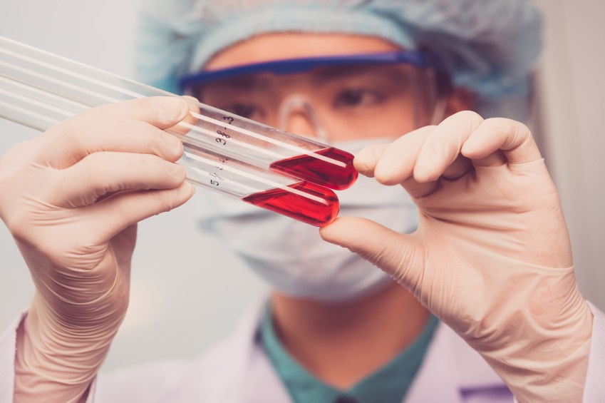 CDC monitoring lab tech for possible Ebola exposure