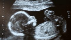 Fact Check: CNN brings in pro-abortion doctors to educate ‘anti-choice’ advocates on late-term abortions