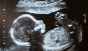 Abortion pill case isn’t the win pro-lifers think it is