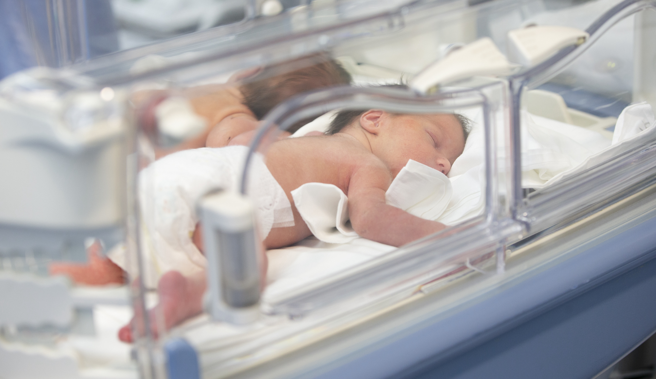 Woman delivers two sets of identical twins after ‘1 in 10 million’ pregnancy
