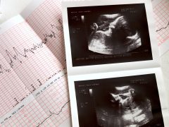 NIH fetal experimentation funding sponsors infanticide