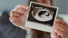 Professor who compared fetuses and cancers tries to explain