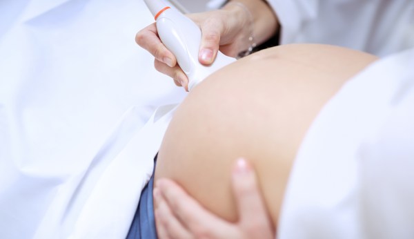 The pro-life movement should pivot to birth affordability