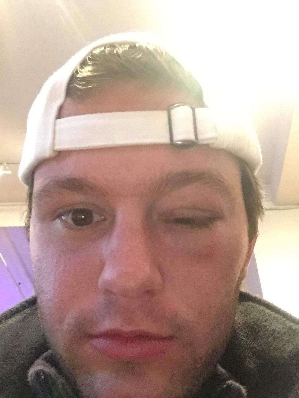 UC Berkeley Victim