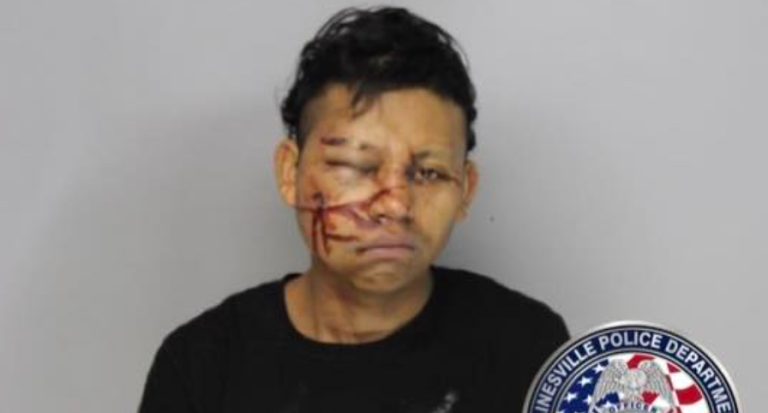 Would-be robber slips on ice and hits head while trying to flee scene