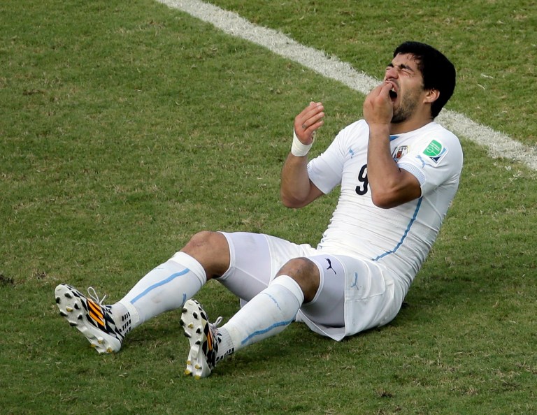 Uruguay's Luis Suarez (9) holds his teeth after running into Italy's Giorgio Chiellini's shoulder during the group D World Cup soccer match between Italy and Uruguay at the Arena das Dunas in Natal, Brazil, Tuesday, June 24, 2014. (AP Photo/Hassan Ammar)