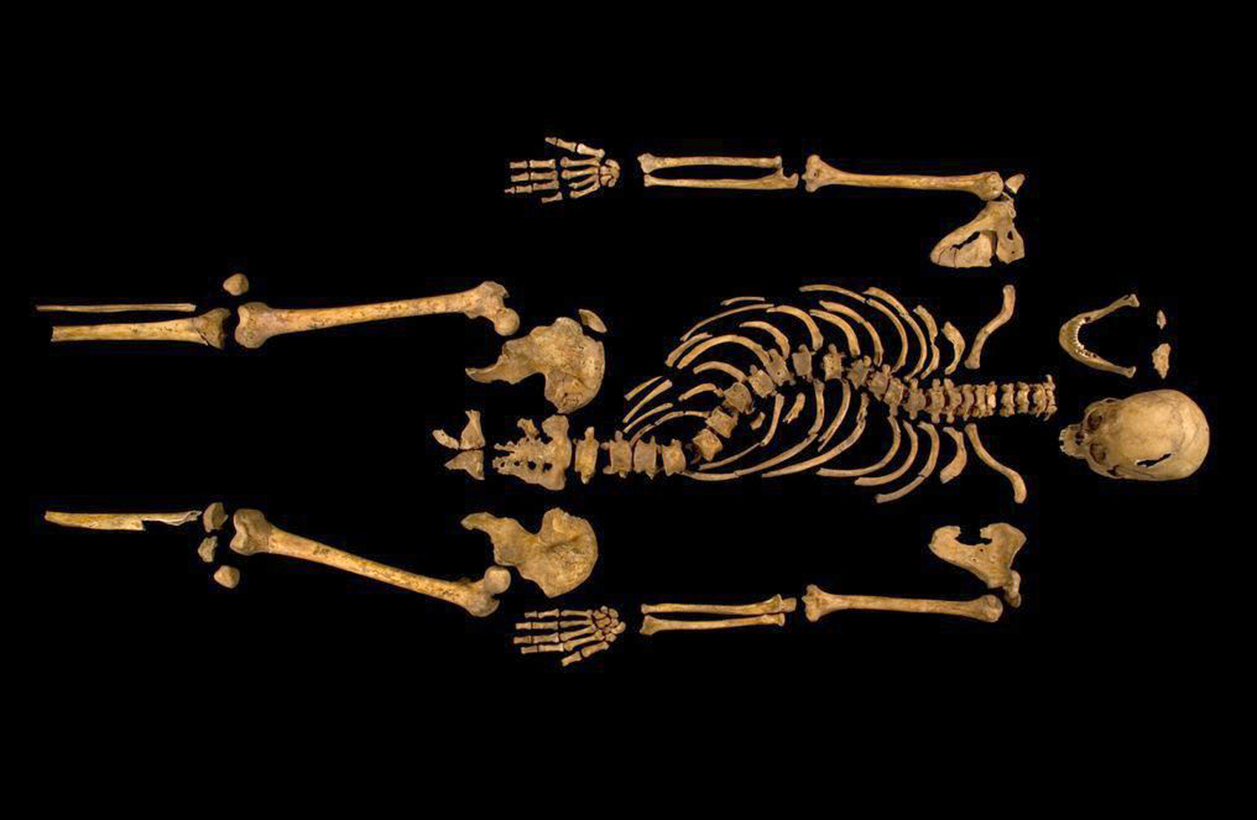 Skeletons don’t have gender? Richard III would disagree