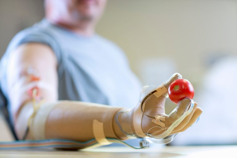 This undated handout image provided by Case Western Reserve University shows Igor Spetic of Madison, Ohio, holding a tomato he picked it up without losing a drop of juice. Scientists are moving closer to an artificial hand that can feel: Implanted electrodes allowed some amputees to tell by touch how gently to grasp, letting them pluck fruit without crushing it. (AP Photo/Russell Lee, Case Western Reserve University)