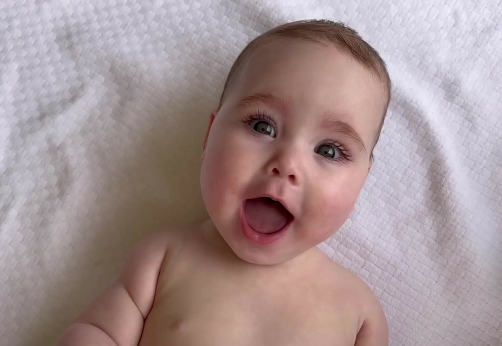Gerber introduces ‘spokesbaby’ born without femur