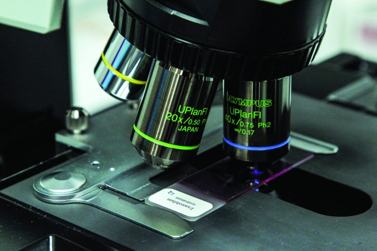 A closeup view of a microscope taking a look at a slide meningitis causing fungus Exserohilum rostratum at the Mycotic lab at the Centers for Disease Control and Prevention on Oct. 12, 2012 in Atlanta. The staff and technicians have been working around the clock to confirm cases and inform the public regarding the multi-state meningitis outbreak that has resulted in 14 deaths. The fungal outbreak is believed to have started at New England Compounding Center where a steroid injection shipment was contaminated with the fungus. (AP Photo/Pouya Dianat)