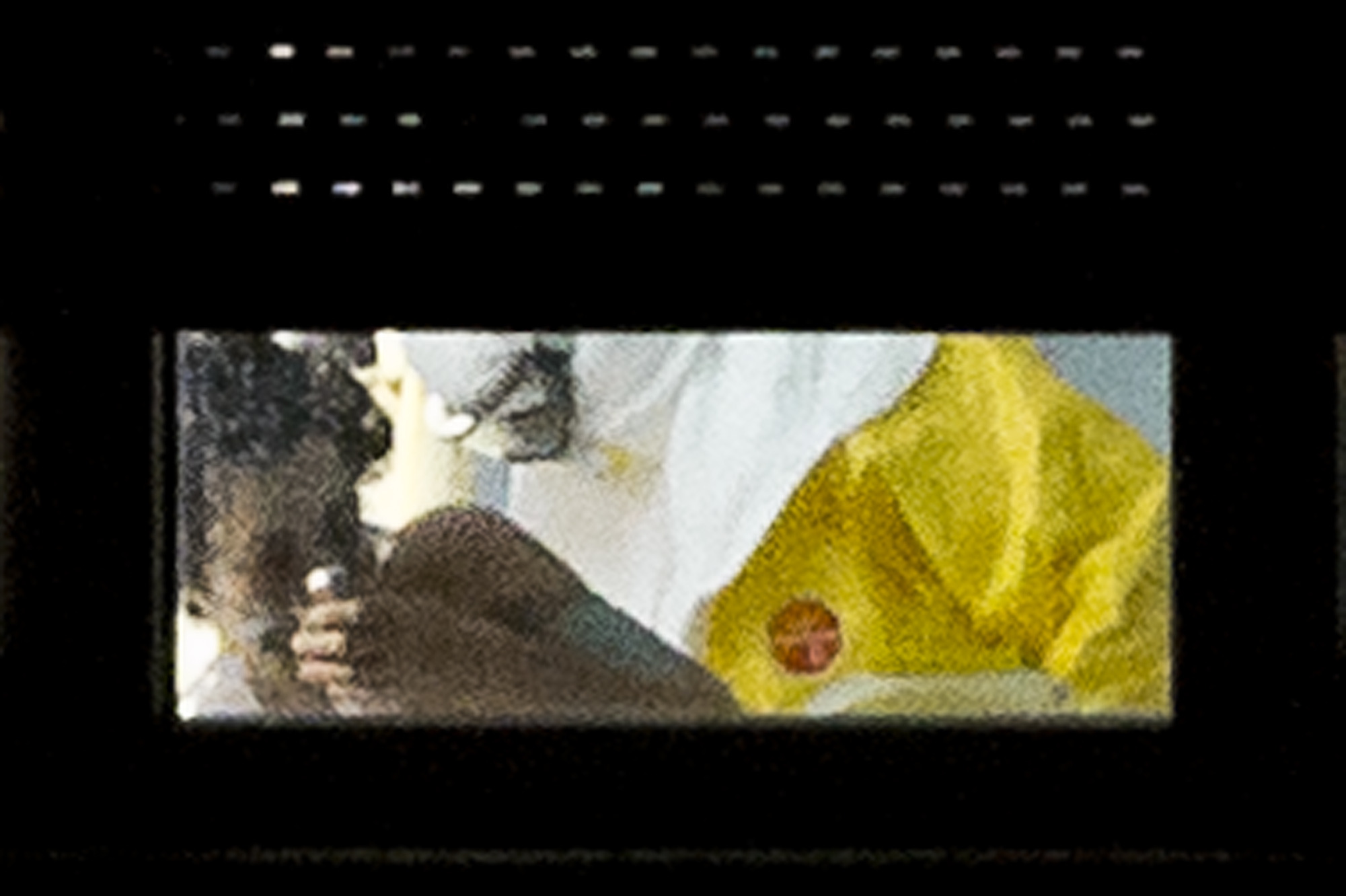 Spanish nurse infected with Ebola makes progress